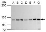 GEF-H1 Antibody in Western Blot (WB)