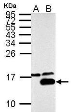 Galectin 7 Antibody in Western Blot (WB)