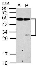 EPCR Antibody in Western Blot (WB)