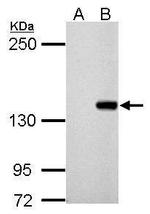 DNMT3B Antibody in Western Blot (WB)