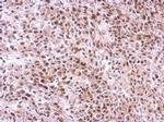 SLU7 Antibody in Immunohistochemistry (Paraffin) (IHC (P))