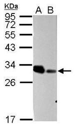 ARD1A Antibody in Western Blot (WB)