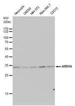 ARD1A Antibody in Western Blot (WB)