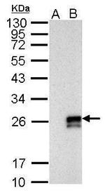 Influenza A NS1 Antibody in Western Blot (WB)