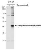 Dengue Virus Type 2 Envelope Antibody in Western Blot (WB)