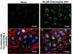 LC3B Antibody in Immunocytochemistry (ICC/IF)