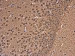 LC3B Antibody in Immunohistochemistry (Paraffin) (IHC (P))