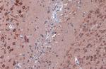 LC3B Antibody in Immunohistochemistry (Paraffin) (IHC (P))