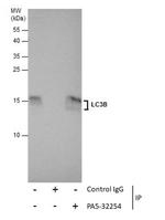 LC3B Antibody in Immunoprecipitation (IP)