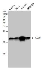 LC3B Antibody in Western Blot (WB)