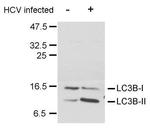 LC3B Antibody in Western Blot (WB)