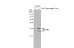 LC3B Antibody in Western Blot (WB)