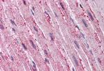 ADAMTS4 Antibody in Immunohistochemistry (Paraffin) (IHC (P))