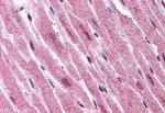 ADAMTS4 Antibody in Immunohistochemistry (Paraffin) (IHC (P))