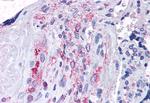 ADAMTS5 Antibody in Immunohistochemistry (Paraffin) (IHC (P))