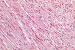 Caveolin 1 Antibody in Immunohistochemistry (Paraffin) (IHC (P))