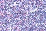 CCR4 Antibody in Immunohistochemistry (Paraffin) (IHC (P))