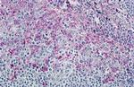 CCR8 Antibody in Immunohistochemistry (Paraffin) (IHC (P))