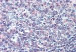 CD70 Antibody in Immunohistochemistry (Paraffin) (IHC (P))