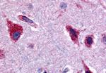 CERK Antibody in Immunohistochemistry (Paraffin) (IHC (P))