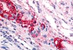 CRHR1 Antibody in Immunohistochemistry (Paraffin) (IHC (P))