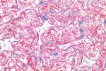 CD26 Antibody in Immunohistochemistry (Paraffin) (IHC (P))