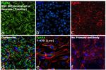 EphA4 Antibody in Immunocytochemistry (ICC/IF)