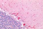 FAP Antibody in Immunohistochemistry (Paraffin) (IHC (P))