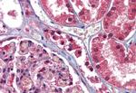 GFPT1 Antibody in Immunohistochemistry (Paraffin) (IHC (P))