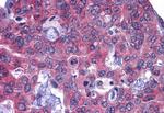 GFPT1 Antibody in Immunohistochemistry (Paraffin) (IHC (P))