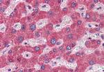 GFPT1 Antibody in Immunohistochemistry (Paraffin) (IHC (P))