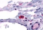 CRTH2 Antibody in Immunohistochemistry (Paraffin) (IHC (P))