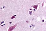 GPR77 Antibody in Immunohistochemistry (Paraffin) (IHC (P))