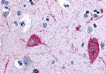 HTR5A Antibody in Immunohistochemistry (Paraffin) (IHC (P))