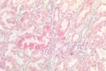 INSR Antibody in Immunohistochemistry (Paraffin) (IHC (P))