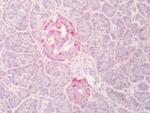 INSR Antibody in Immunohistochemistry (Paraffin) (IHC (P))