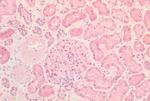 INSR Antibody in Immunohistochemistry (Paraffin) (IHC (P))