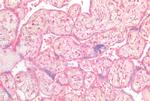 INSR Antibody in Immunohistochemistry (Paraffin) (IHC (P))