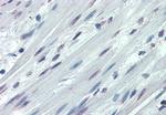 ITGA3 Antibody in Immunohistochemistry (Paraffin) (IHC (P))