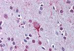 LPAR4 Antibody in Immunohistochemistry (Paraffin) (IHC (P))