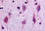 ERK1 Antibody in Immunohistochemistry (Paraffin) (IHC (P))