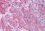 ERK1 Antibody in Immunohistochemistry (Paraffin) (IHC (P))