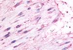 Oxytocin Receptor Antibody in Immunohistochemistry (Paraffin) (IHC (P))