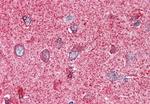 PAK7 Antibody in Immunohistochemistry (Paraffin) (IHC (P))