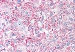 PLA2G3 Antibody in Immunohistochemistry (Paraffin) (IHC (P))