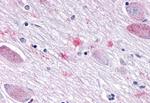 SGK3 Antibody in Immunohistochemistry (Paraffin) (IHC (P))