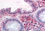 ASCT2 Antibody in Immunohistochemistry (Paraffin) (IHC (P))