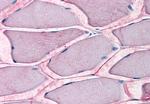 ASCT2 Antibody in Immunohistochemistry (Paraffin) (IHC (P))