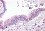 CTR1 Antibody in Immunohistochemistry (Paraffin) (IHC (P))