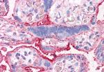 CTR1 Antibody in Immunohistochemistry (Paraffin) (IHC (P))